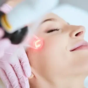 laser