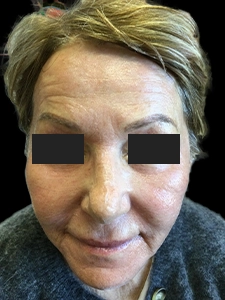 CO2 Full Face 1