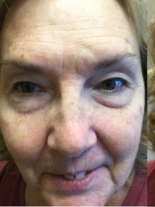 Micro-pigmentation-eyebrow b