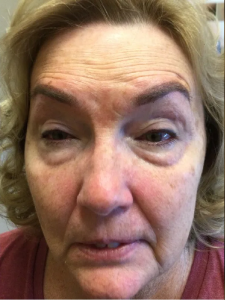 Micro-pigmentation-eyebrow c