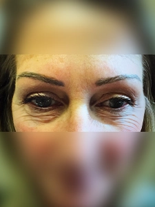 Micro pigmentation eyebrow_1