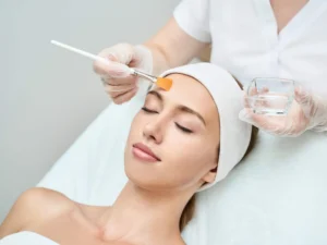 chemical peel