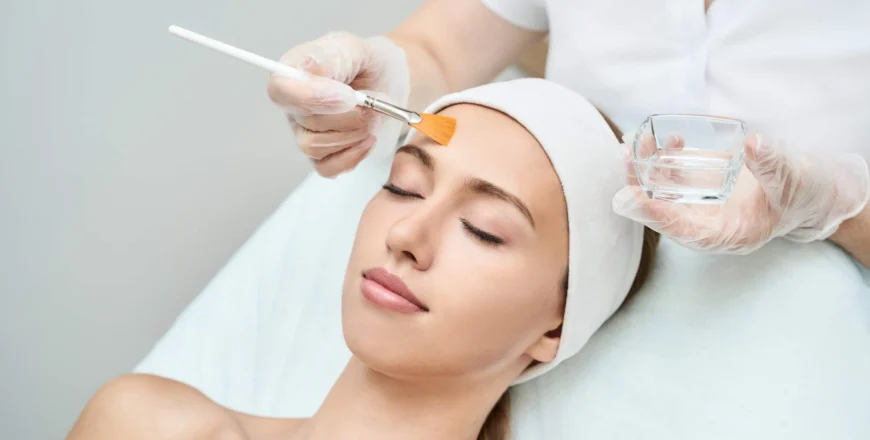 chemical peel