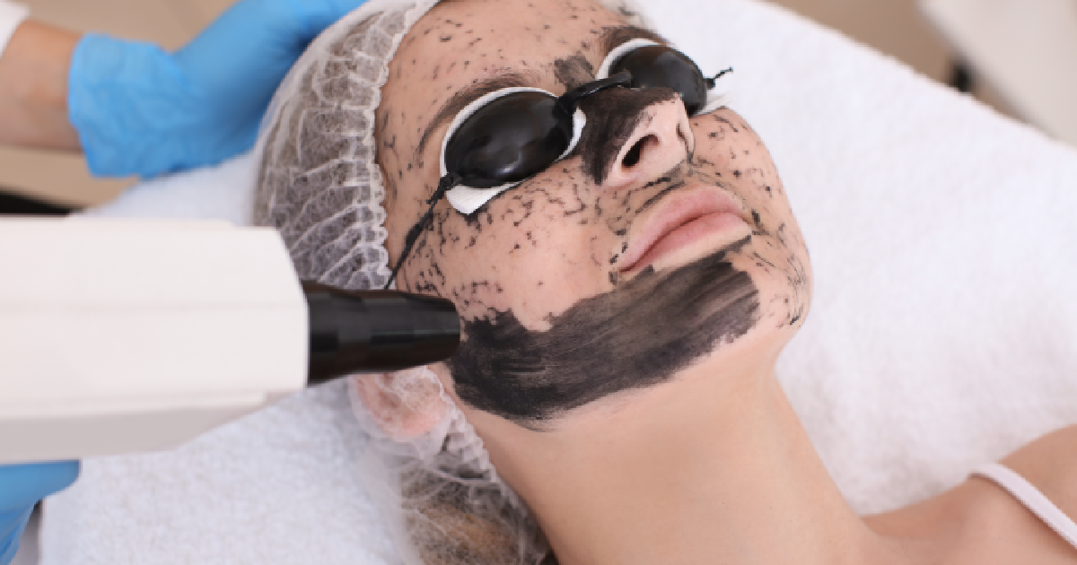 Women receiving Carbon Laser Facial in Broomfield, CO